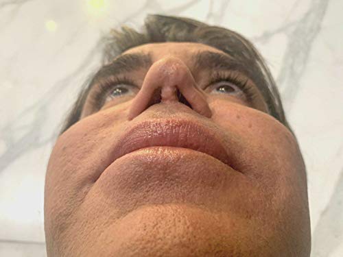 Botched - Season 4